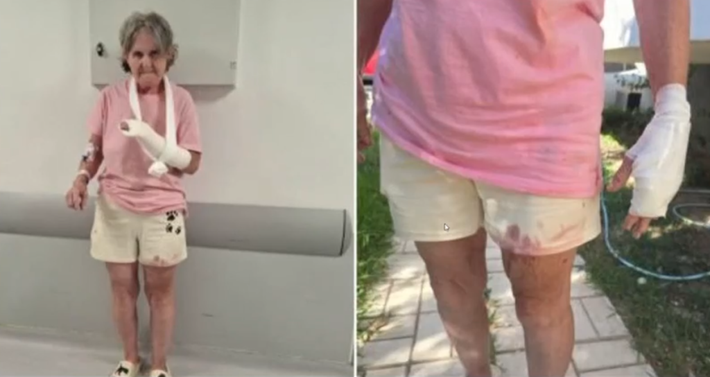 Δημοτική υπάλληλος δέχθηκε επίθεση από σκύλους της οικογένειας Τσιτσιπά