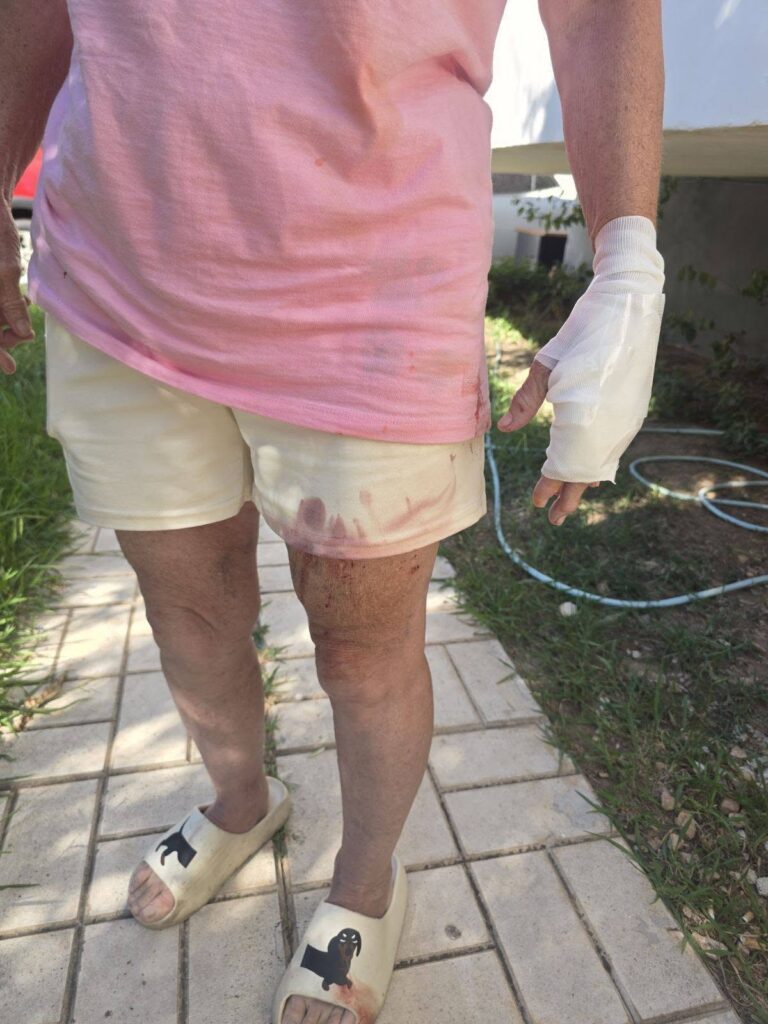 Δημοτική υπάλληλος δέχθηκε επίθεση από σκύλους της οικογένειας Τσιτσιπά