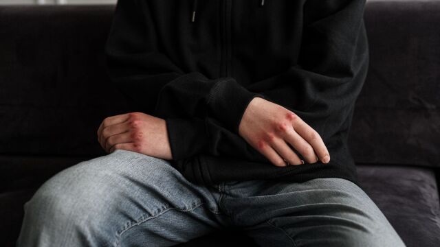 Βριλήσσια: Στο Αυτόφωρο ο 14χρονος που ξυλοκόπησε συμμαθητή του — Κινδυνεύει να χάσει το νεφρό του το θύμα