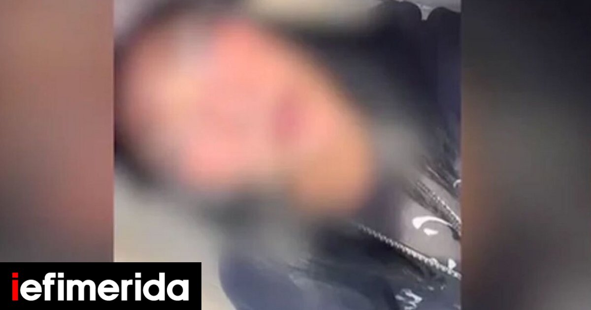 21χρονη από την Πάρο εκτός ΜΕΘ: «Ήθελα να πειραματιστώ», ελεύθερος ο σύντροφός της